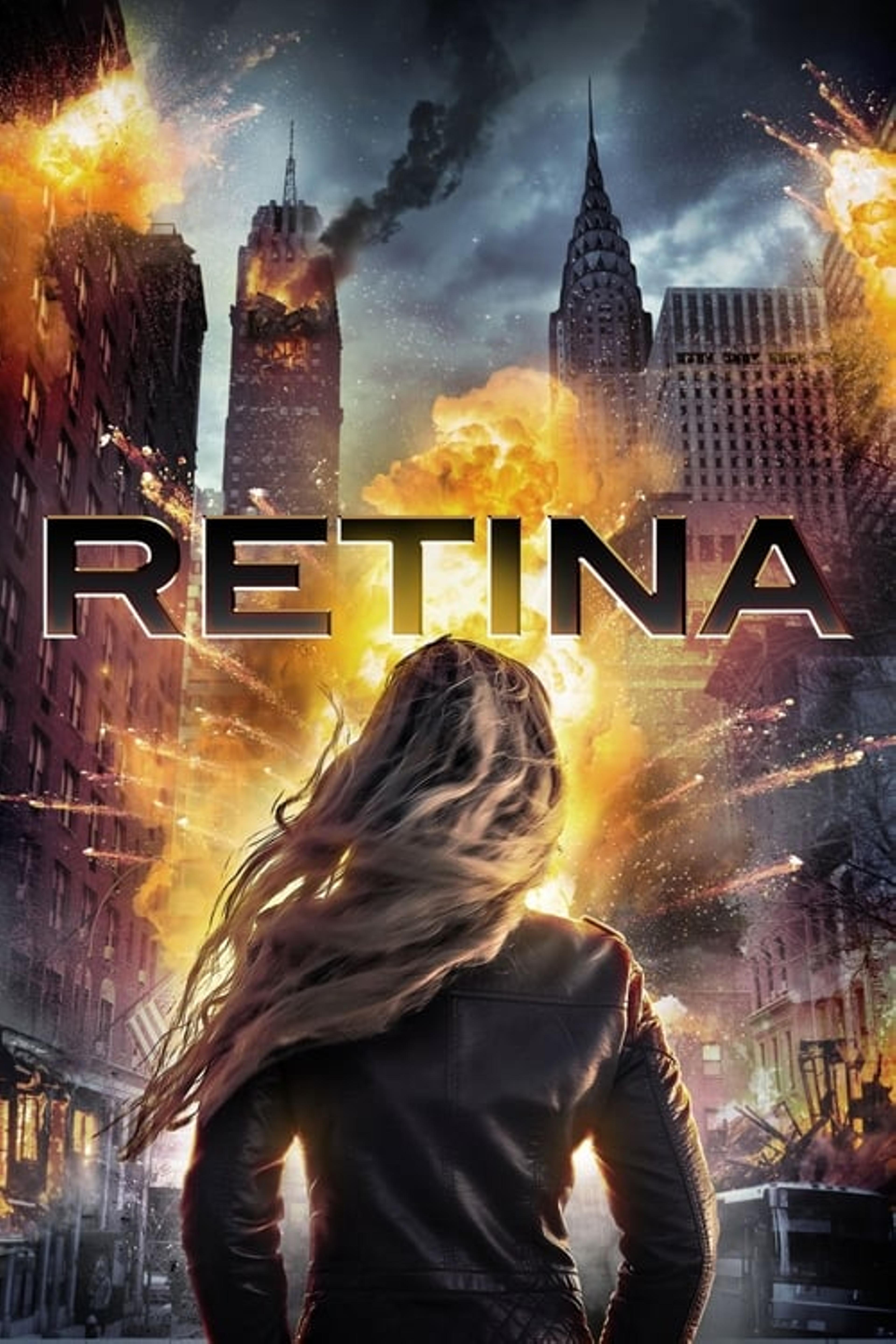 Retina